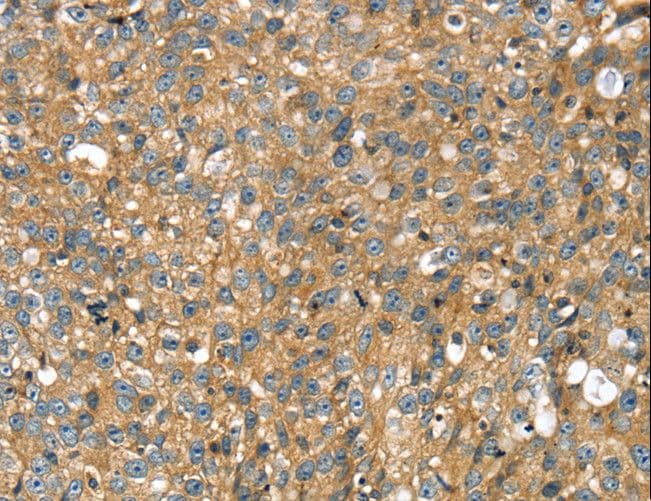 Polyclonal Rabbit anti-Human STX11 / Syntaxin 11 Antibody (IHC, WB)