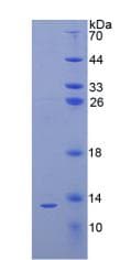 Human PTH / Parathyroid Hormone Protein (Recombinant His)