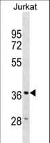 Polyclonal Rabbit anti-Human HMOX2 / Heme Oxygenase 2 Antibody (aa24-52, WB)