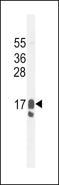 PIP / GCDFP-15 Antibody (aa77-106)