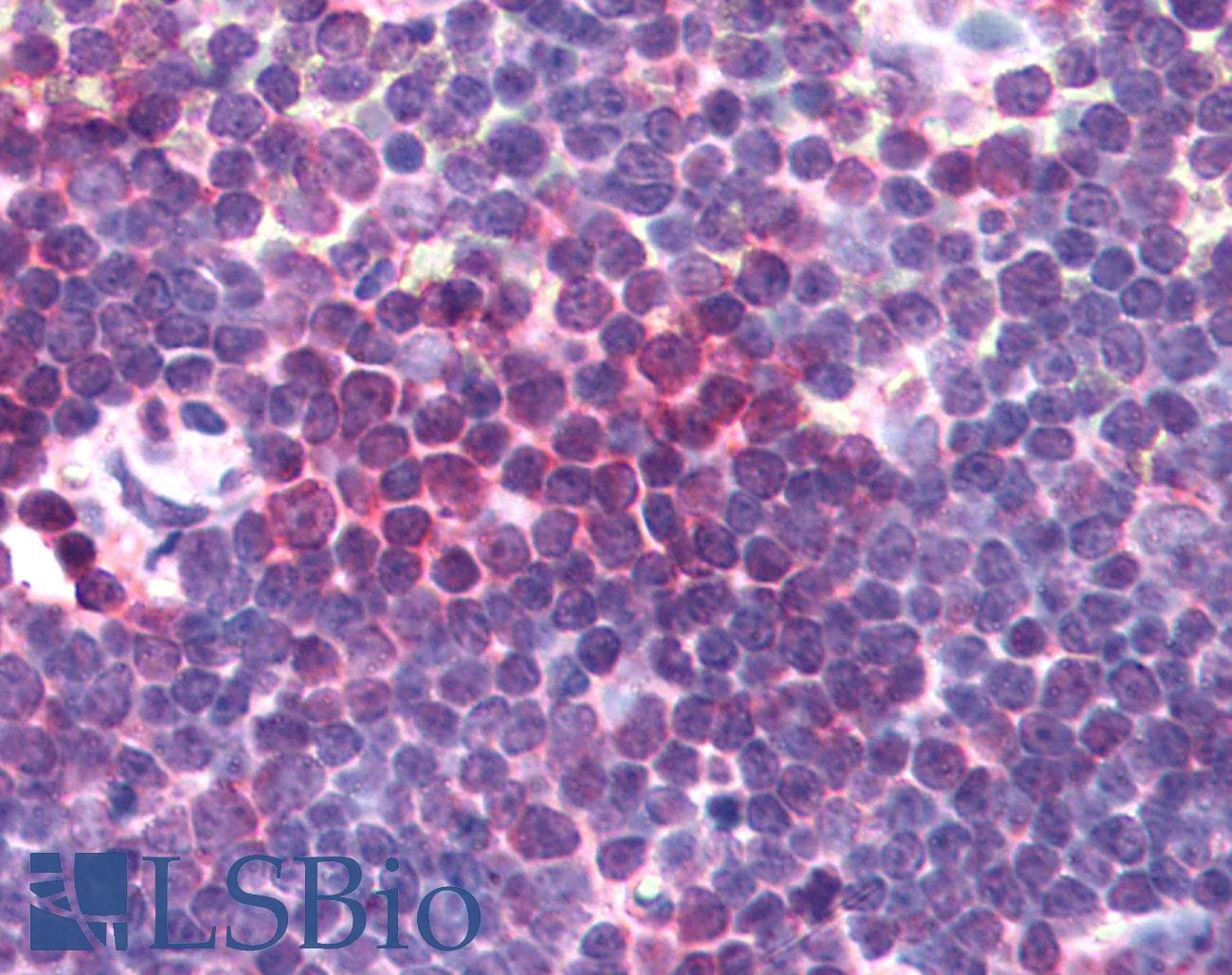 IHC-plus™ AURKA / Aurora-A Antibody (aa394-403)