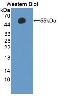 APCS / Serum Amyloid P / SAP Antibody (aa23-223)