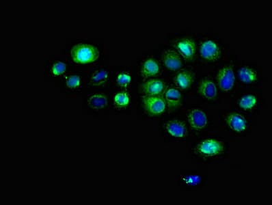 Polyclonal Rabbit anti-Human GJC1 / CX45 / Connexin 45 Antibody (IHC, IF, WB)