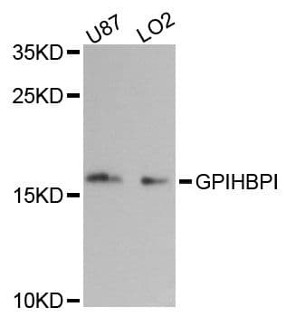 Polyclonal Rabbit anti-Human GPIHBP1 Antibody (WB)