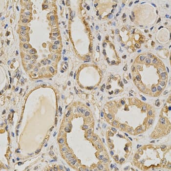 PRMT5 Antibody