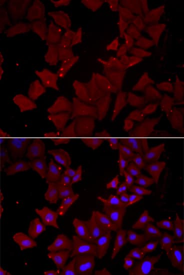 CCT4 / SRB Antibody
