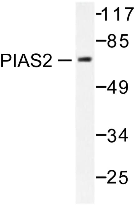 PIAS2 / PIASX Antibody (Gly24)
