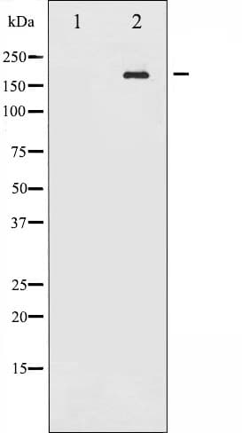 RET Antibody (phospho-Tyr1062)
