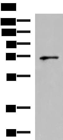Polyclonal Rabbit anti-Human GSPT2 Antibody (IHC, WB)