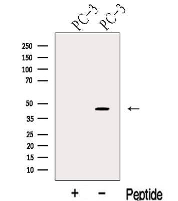 KLF6 Antibody