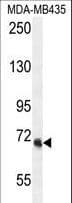 Polyclonal Rabbit anti-Human VPS52 / SACM2L Antibody (aa610-637, IHC, IF, WB)