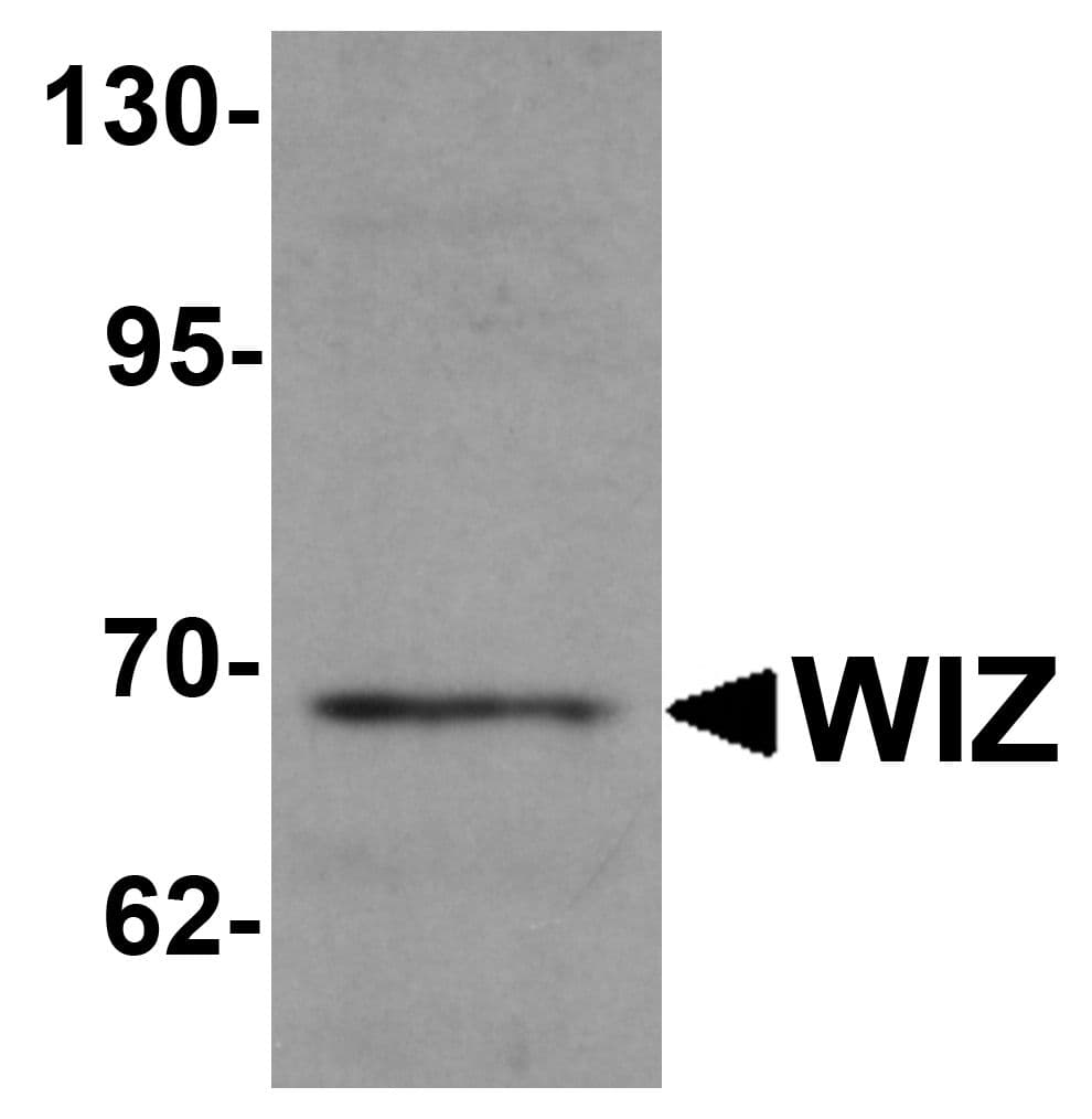 Polyclonal Rabbit anti-Human WIZ Antibody (IHC, IF, WB)