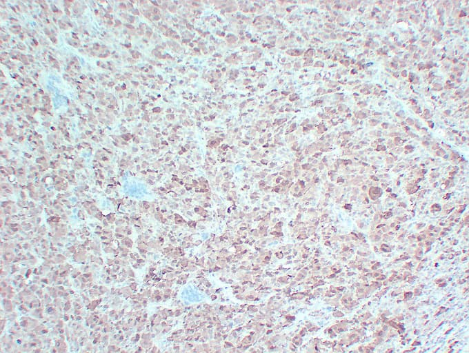 S100B / S100 Beta Antibody (clone ABT-S100B)