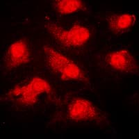 NEK9 Antibody (phospho-Thr210)