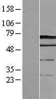 SMIF / DCP1A Protein (Over-Expression Lysate Myc-DDK (Flag))