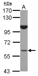 Polyclonal Rabbit anti-Human BTBD16 Antibody (WB)