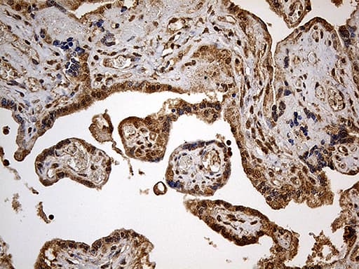 Monoclonal Mouse anti-Human DNAH6 Antibody (clone OTI5C2, IHC, WB)