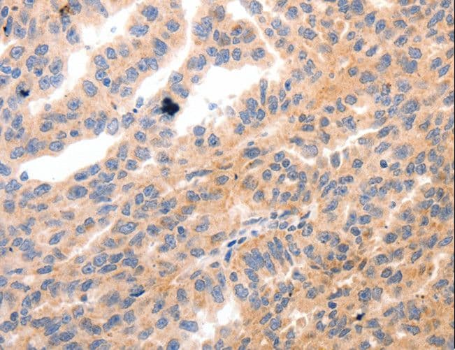 MLC2 / MYL9 Antibody