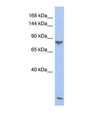 PDE6A / PDE6 Alpha Antibody (aa99-148)