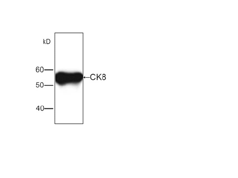 KRT8 / CK8 / Cytokeratin 8 Antibody