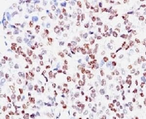 MITF Antibody (N-Terminus, clone SPM290)