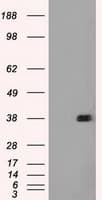 FCGR2 / CD32 Antibody (clone OTI6D11)