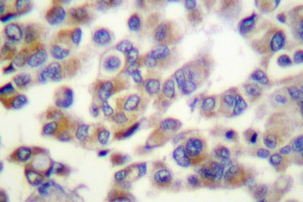 WNT1 Antibody (Gly331)