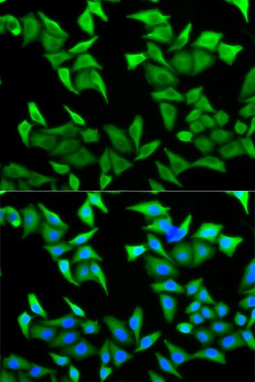 IHC-plus™ PVRL2 / CD112 Antibody