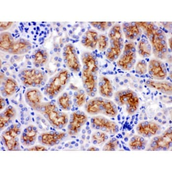 CYP24 / CYP24A1 Antibody (aa153-514)