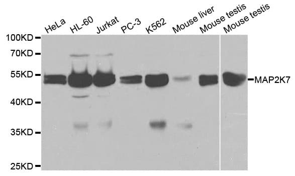 Polyclonal Rabbit anti-Human MAP2K7 / MEK7 Antibody (IHC, IF, WB)