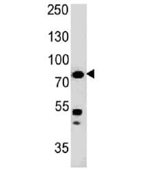 Monoclonal Mouse anti-Human MSN / Moesin Antibody (clone MSN/491, Azide-free,BSA-free, IHC, IF, WB)