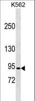 ClC-5 / CLCN5 Antibody (aa15-41)