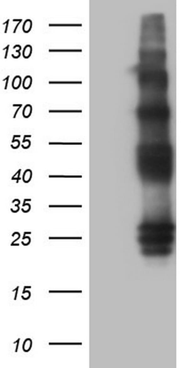 Monoclonal Mouse anti-Human PROCR / EPCR Antibody (clone OTI2G2, aa1-210, WB)