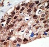 SETD7 / SET7 Antibody (aa159-189)