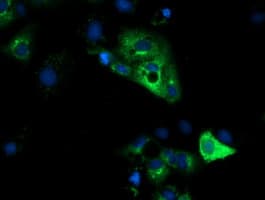 HP / Haptoglobin Antibody (clone OTI4C2)
