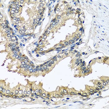 CST1 / Cystatin SN Antibody