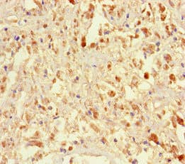 IFT46 Antibody