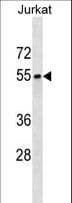 SEPT6 / Septin 6 Antibody (aa400-426)