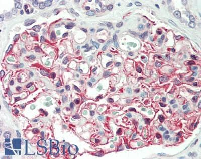 Polyclonal Rabbit anti-Human GRN / Granulin Antibody (aa234-419, IHC, WB)