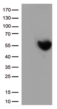 CD274 / B7-H1 / PD-L1 Antibody (clone OTI2C11)