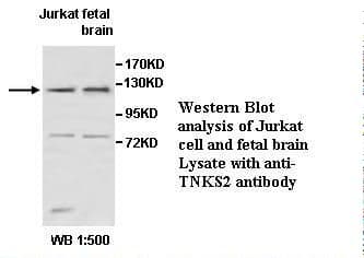 Polyclonal Rabbit anti-Human TANK2 / TNKS2 Antibody (IHC, WB)