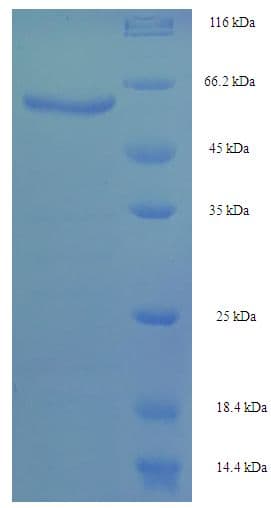 Aspergillus niger 3-Phytase A Protein (Recombinant His-SUMO)