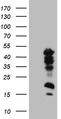 CREM / ICER Antibody (clone OTI4H9)