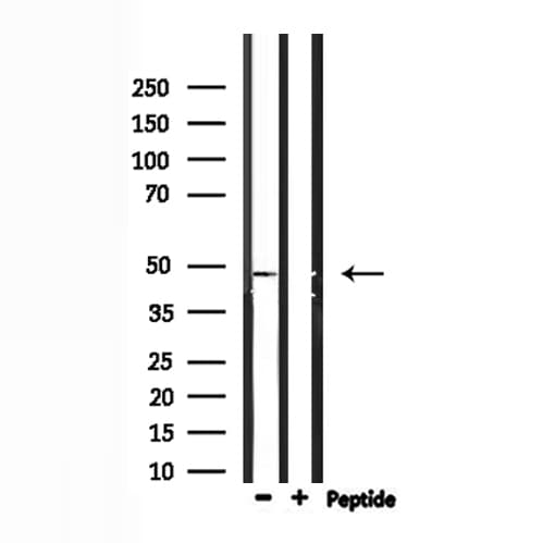 IP6K2 Antibody