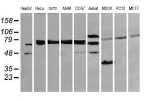 Monoclonal Mouse anti-Human DEF6 Antibody (clone OTI1E3, IHC, IF, WB)