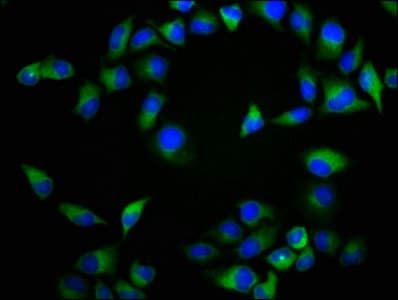 Polyclonal Rabbit anti-Human NTSR2 / NTR2 Antibody (IHC, WB)