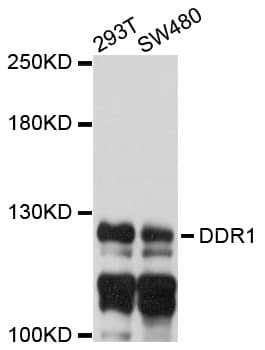 NEP / DDR1 Antibody