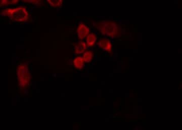 PDXDC1 Antibody