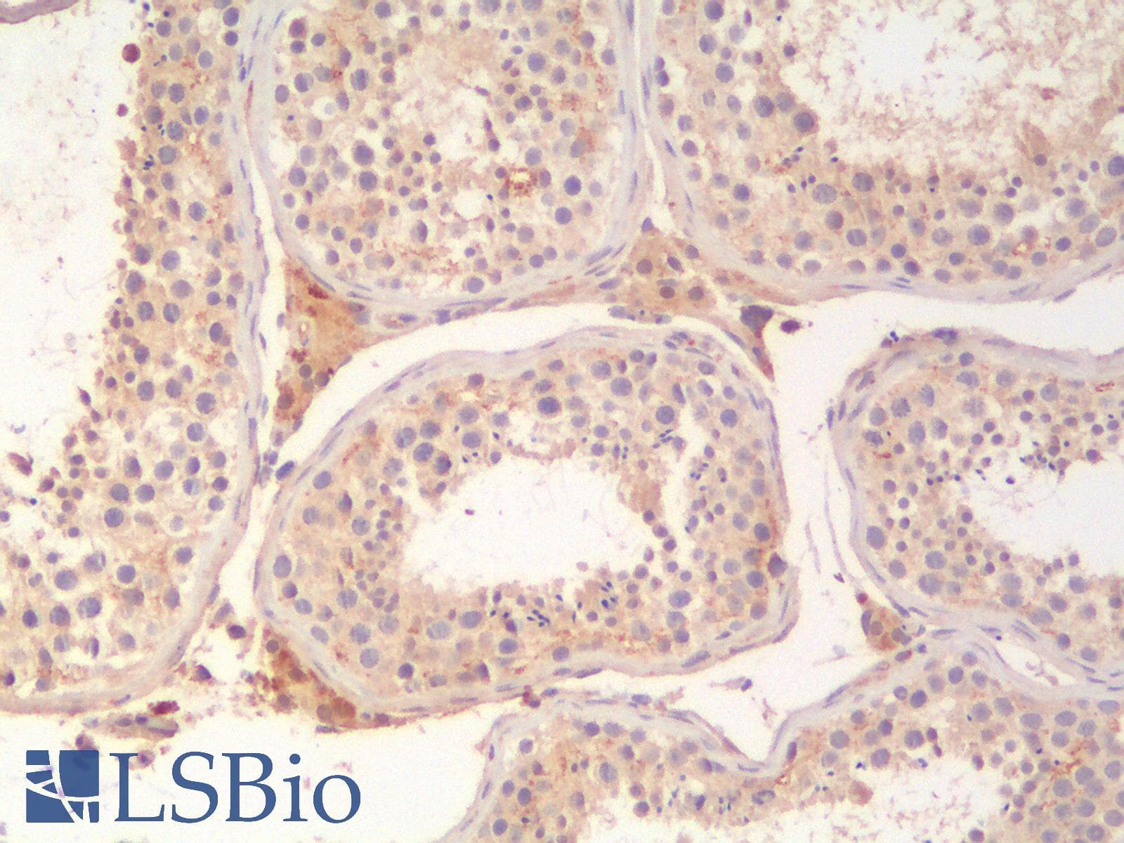 IHC-plus™ ABCB11 / BSEP Antibody (Concentrated)