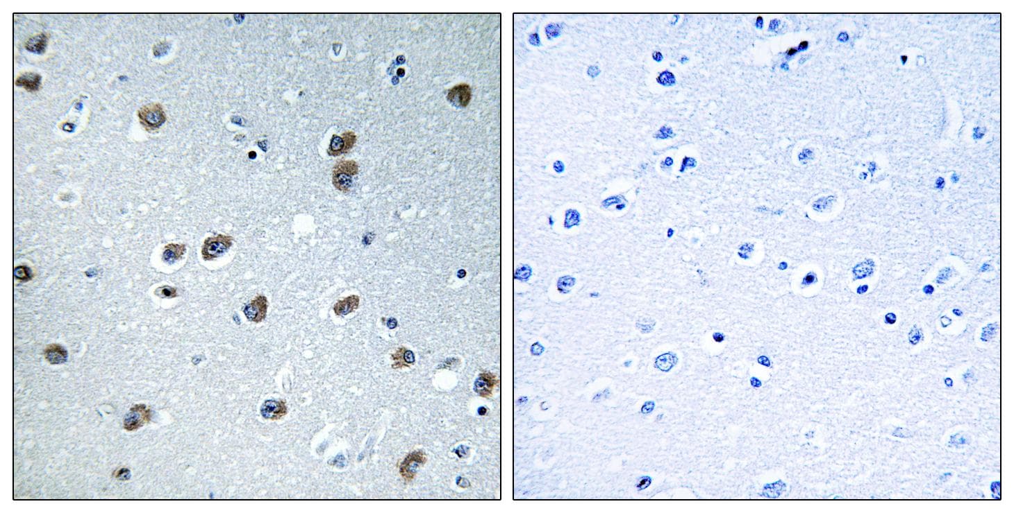Polyclonal Rabbit anti-Human KLHL29 Antibody (IHC)